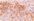 3 Core HER2/NEU