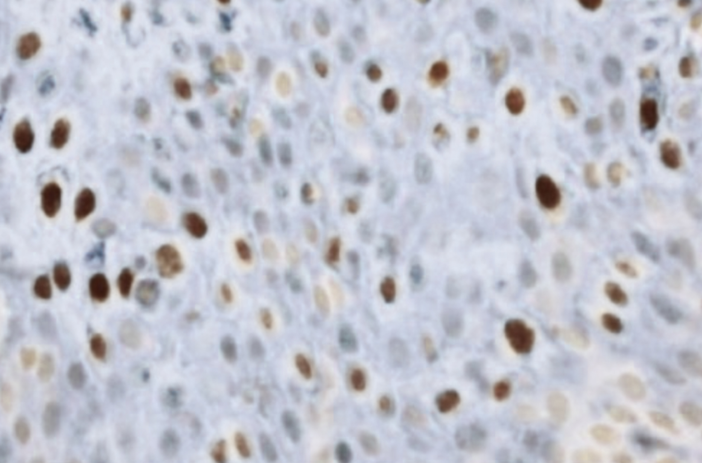 P16 Tissue