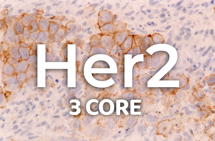 Her2/Neu 3 Core Controls